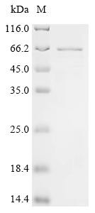 N6-adenosine-methyltransferase non-catalytic subunit (METTL14), human, recombinant
