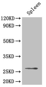 Anti-BDNF