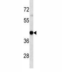 Anti-HLA-A, clone 7G7F9