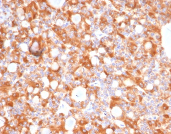 Anti-Renal Cell Carcinoma (Carbonic Anhydrase IX), clone CA9/4019