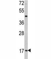 Anti-Leptin