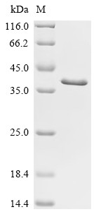Vigilin (HDLBP), partial, human, recombinant