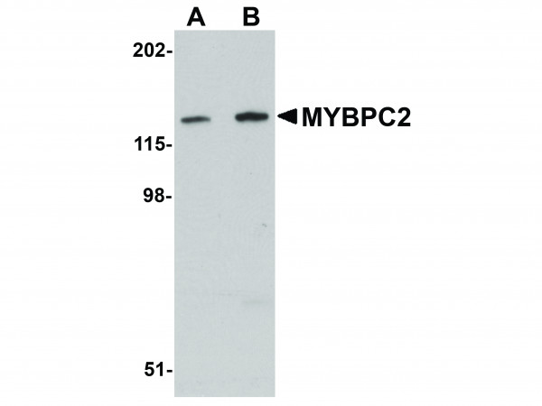 Anti-MYBPC2