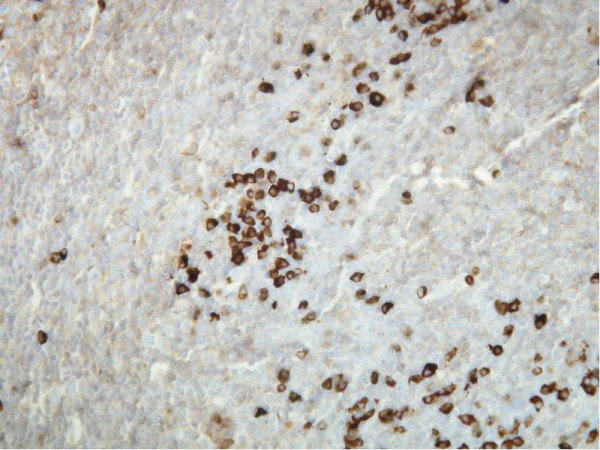 Anti-Human Kappa light chain, clone A21-Y