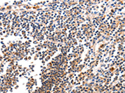 Anti-BCL2L15