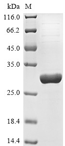 Glutathione S-transferase P (GSTP1), Cricetulus longicaudatus, recombinant