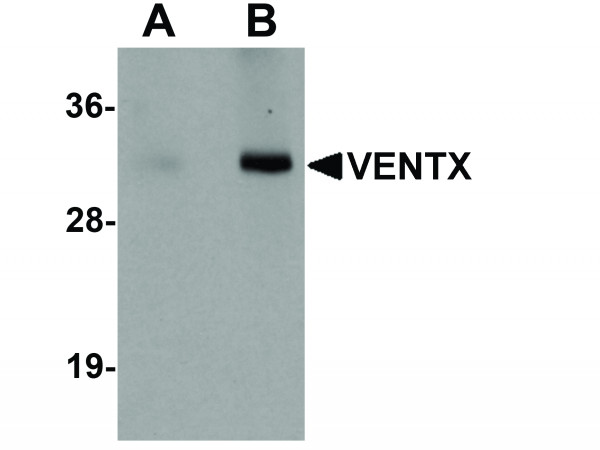 Anti-VENTX