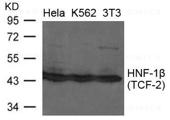 Anti-HNF-1beta(TCF-2)