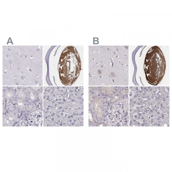 Anti-BFSP2