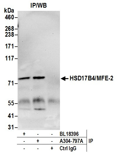 Anti-HSD17B4/MFE-2/17-beta-HSD4