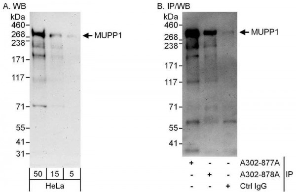 Anti-MUPP1