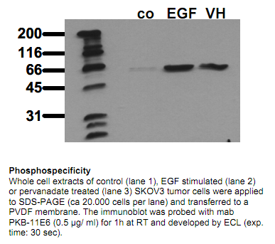 Anti-phospho-PKB (Akt) (Ser473), clone 11E6