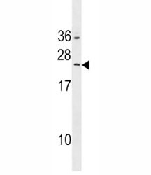 Anti-RAB5B