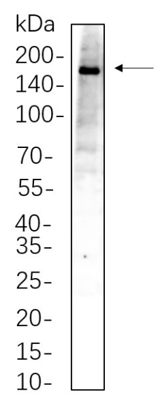 Anti-Recombinant TBC1D4, clone 11A2