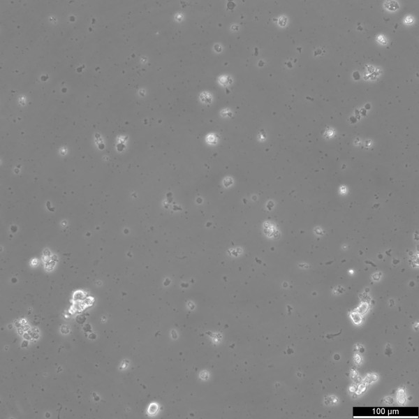 SCLC-21H Cells