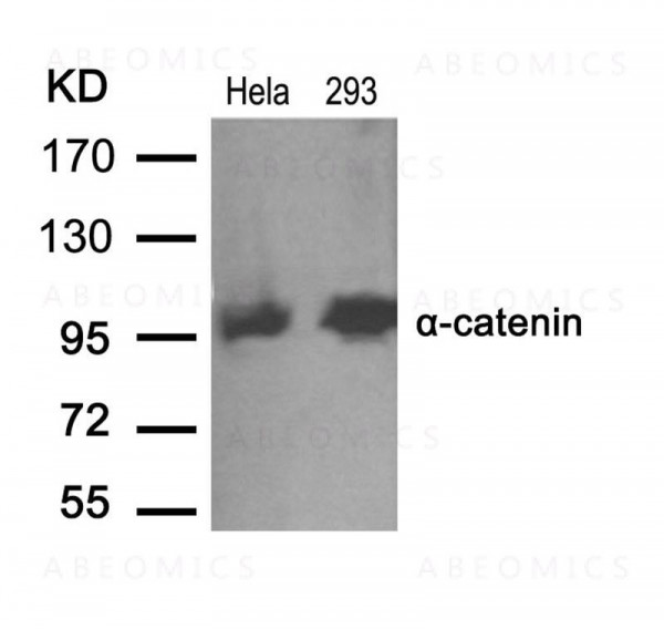 Anti-Alpha-catenin (Ab-641)