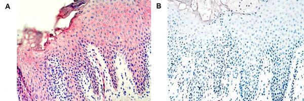 Anti-Vaspin (human), clone VP63