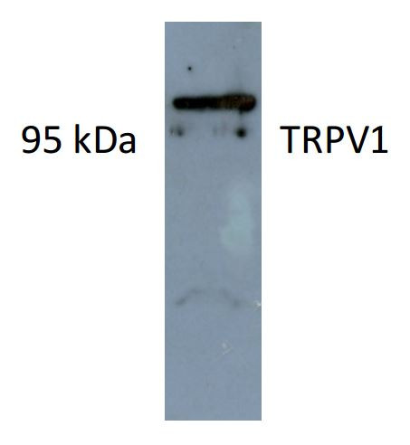 Anti-TrpV1