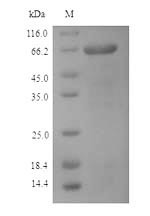 Nucleoprotein (NP), Influenza B virus, recombinant