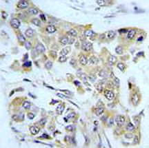 Anti-Cadherin 8