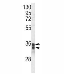Anti-STING (TMEM173)