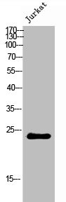 Anti-CYB561D2