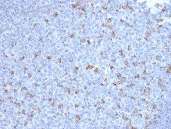 Anti-PDCD1 / PD1 / CD279 (Programmed Cell Death 1) Monoclonal Antibody (Clone: PDCD1/2720)