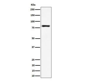 Anti-LTK / Leukocyte tyrosine kinase receptor, clone 29L03