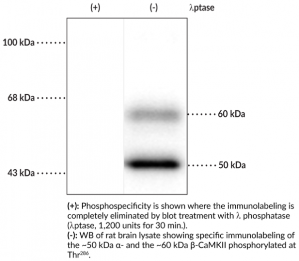 Anti-CaMKII (Phospho-Thr286)