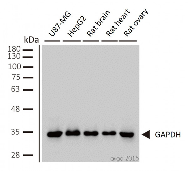 Loading Control Antibody Panel (Actin, beta Tublin, Histone H3, GAPDH)