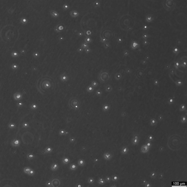 B-LCL-CDG5 Cells