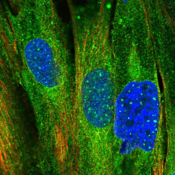 Anti-MRVI1