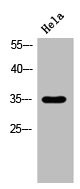 Anti-HSD11B1