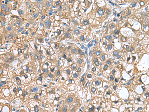 Anti-IGLL1