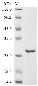 Myoglobin (MB), Macaca fascicularis, recombinant