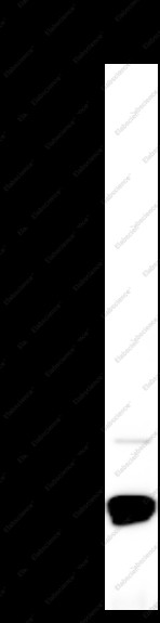 Anti-Recombinant Cystatin C, clone C112289