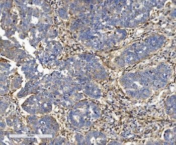Anti-ITGB5 / Integrin beta 5, clone 9E2.