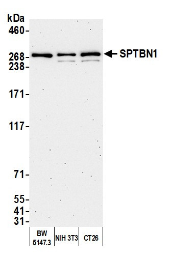 Anti-SPTBN1
