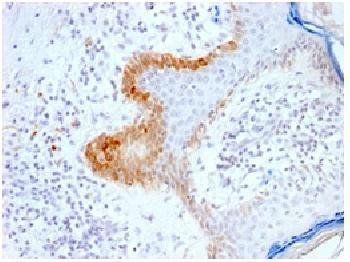 Anti-Cytokeratin 15 (KRT15) (Basal Cell Marker) Recombinant Rabbit Monoclonal Antibody (clone:KRT15/