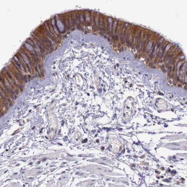 Anti-IGBP1