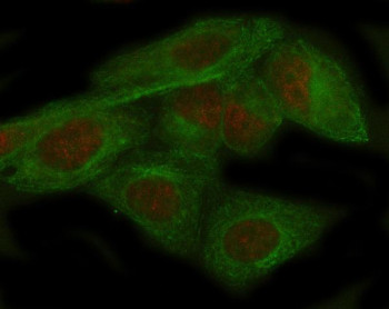 Anti-ADAR / Adenosine deaminase acting on RNA, clone AFCB-1