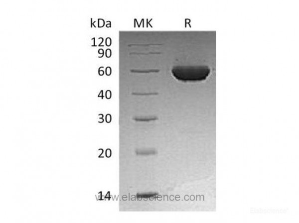 Aldehyde Dehydrogenase 1-A2/ALDH1A2 Protein(N-6His) (recombinant human)