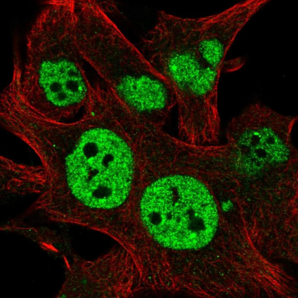 Anti-TESK2