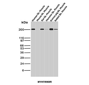 Anti-MYH7 / Myosin 7, clone MYH7/9969R
