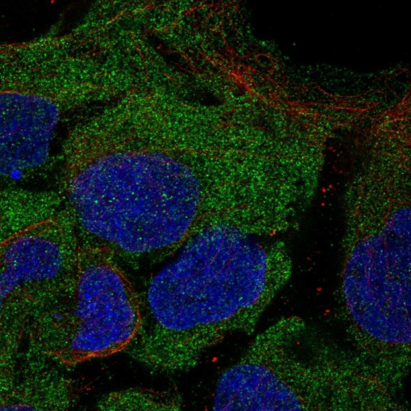Anti-CD8B