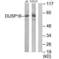 Anti-DUSP16
