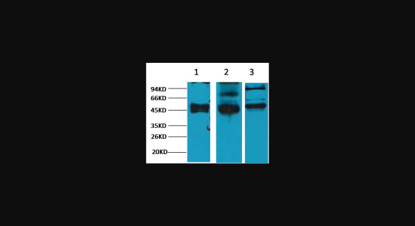 Anti-CK17, monoclonal