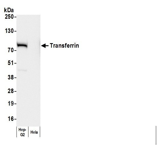 Anti-Human Transferrin