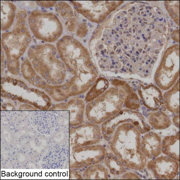 Anti-IDH3A