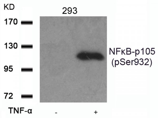 Anti-phospho-NFkB p105 (Ser932)